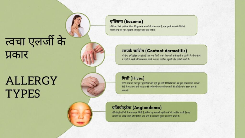 त्वचा एलर्जी - कारण, लक्षण और इलाज Allergy – Causes, Symptoms and Treatment 2 त्वचा एलर्जी के प्रकार